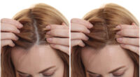 Healthy Scalp Care | Martino Cartier Salon NJ Guide